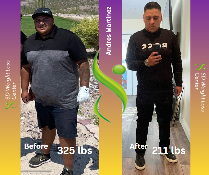 before and after 5
